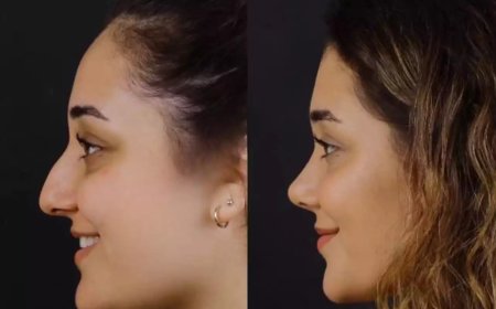 Experience Matters: The Best Septoplasty Surgeons in Dubai Explained