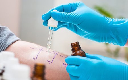 Complete Guide to Allergy Testing in Chicago: Types, Costs, and What to Expect