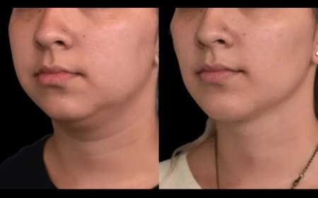 How the Best Double chin removal Surgeons in Dubai Tailor Treatments to Skin Types