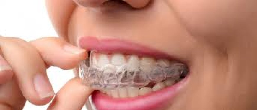 Invisalign in Dubai: The Clear Solution to Straightening Your Teeth