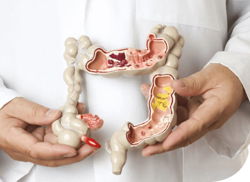 Top Colorectal Surgeon Mumbai: Your Guide to Expert Care and Advanced Treatment Options