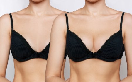 Plump Perfection With Breast Fillers Injections