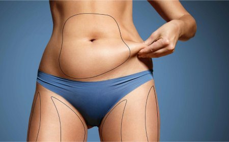 Abdominoplasty in Dubai: How Safe Is Abdominoplasty Surgery and What Are the Long-Term Effects