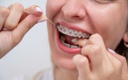 Are Invisalign Braces Difficult to Keep Clean?