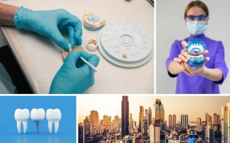 Dental Implants in Colombia: Your Guide to Safe, Affordable, and Stunning Results