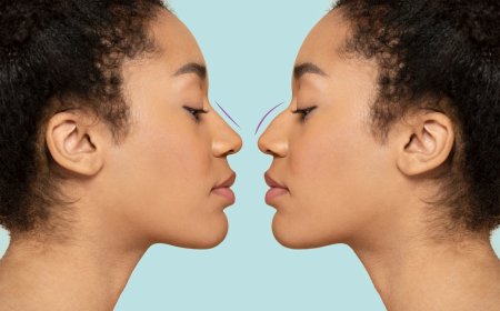 The Best Surgeons for Preservation Rhinoplasty in Dubai: How to Choose