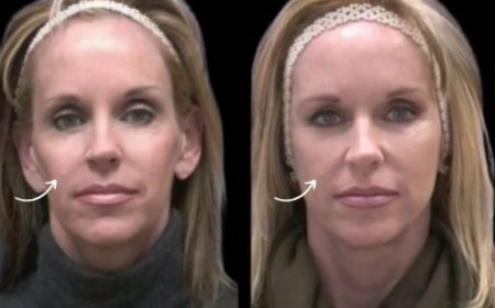 Best Plastic Surgeons in Dubai: Sculptra Fillers & Virtual Reality Before/After