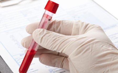 How to Track Changes in Your Health with Regular Blood Tests at Home