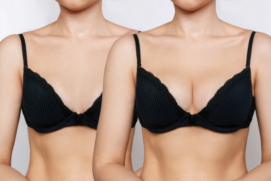 Plump Perfection With Breast Fillers Injections