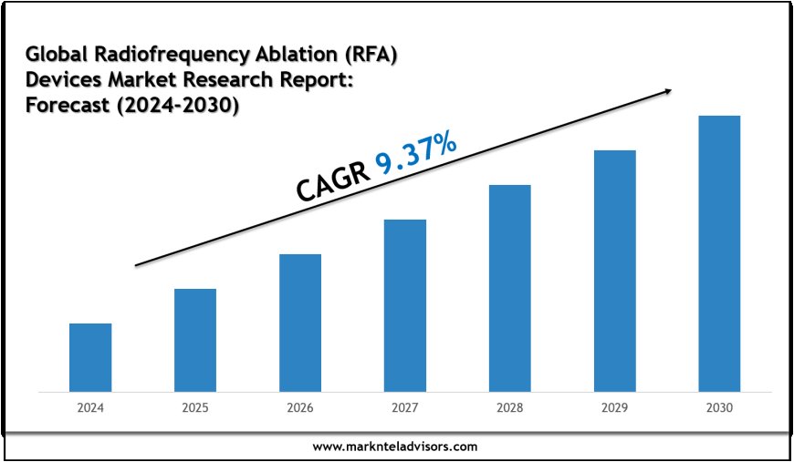 2024–2030 Global Radiofrequency Ablation (RFA) Devices Industry Outlook: Trends Led by Pajunk, Abbott, Medtronic